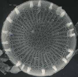 Diatom